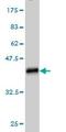 Nicotinamide Nucleotide Adenylyltransferase 2 antibody, ab56980, Abcam, Western Blot image 