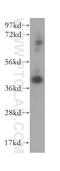 Archaelysin Family Metallopeptidase 2 antibody, 16664-1-AP, Proteintech Group, Western Blot image 