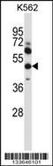 Matrix Metallopeptidase 13 antibody, MBS9202064, MyBioSource, Western Blot image 