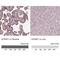 EGF Containing Fibulin Extracellular Matrix Protein 1 antibody, NBP2-57871, Novus Biologicals, Immunohistochemistry paraffin image 