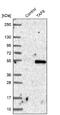 TATA-Box Binding Protein Associated Factor 8 antibody, NBP2-38189, Novus Biologicals, Western Blot image 