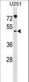 ILK Associated Serine/Threonine Phosphatase antibody, LS-C157836, Lifespan Biosciences, Western Blot image 