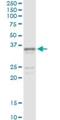 Sarcoglycan Gamma antibody, H00006445-M02, Novus Biologicals, Immunoprecipitation image 