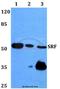 Serum Response Factor antibody, A00557, Boster Biological Technology, Western Blot image 