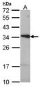 Tetraspanin 1 antibody, LS-C186018, Lifespan Biosciences, Western Blot image 