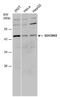 Histone-lysine N-methyltransferase SUV39H2 antibody, PA5-78581, Invitrogen Antibodies, Western Blot image 