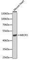 Methyl-CpG Binding Protein 2 antibody, 14-922, ProSci, Western Blot image 