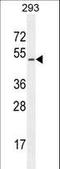 Chordin Like 1 antibody, LS-C168749, Lifespan Biosciences, Western Blot image 