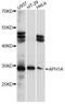 Aph-1 Homolog A, Gamma-Secretase Subunit antibody, A14666, ABclonal Technology, Western Blot image 