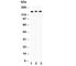 Insulin Receptor antibody, R30701, NSJ Bioreagents, Western Blot image 