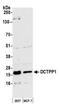 DCTP Pyrophosphatase 1 antibody, NBP2-76374, Novus Biologicals, Western Blot image 