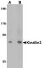 Fermitin Family Member 3 antibody, NBP1-76349, Novus Biologicals, Western Blot image 