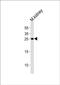 Claudin 6 antibody, PA5-49420, Invitrogen Antibodies, Western Blot image 