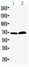 Peptidyl Arginine Deiminase 4 antibody, LS-C313169, Lifespan Biosciences, Western Blot image 