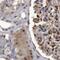 RAD23 Homolog B, Nucleotide Excision Repair Protein antibody, PA5-56237, Invitrogen Antibodies, Immunohistochemistry paraffin image 