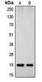 Synuclein Beta antibody, MBS821058, MyBioSource, Western Blot image 