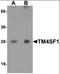 Transmembrane 4 L Six Family Member 1 antibody, orb95637, Biorbyt, Western Blot image 