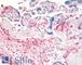 Dipeptidyl Peptidase 4 antibody, LS-A8061, Lifespan Biosciences, Immunohistochemistry frozen image 