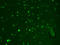 Hyperpolarization Activated Cyclic Nucleotide Gated Potassium And Sodium Channel 2 antibody, TA326544, Origene, Immunofluorescence image 