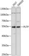 Phospholipid Transfer Protein antibody, GTX33416, GeneTex, Western Blot image 