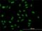 Muscleblind Like Splicing Regulator 1 antibody, H00004154-M02, Novus Biologicals, Immunocytochemistry image 