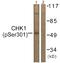 Checkpoint Kinase 1 antibody, P30437, Boster Biological Technology, Western Blot image 