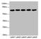 Karyopherin Subunit Alpha 6 antibody, LS-C675965, Lifespan Biosciences, Western Blot image 