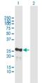 MIS12 Kinetochore Complex Component antibody, H00079003-B02P, Novus Biologicals, Western Blot image 