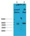 Gamma-Aminobutyric Acid Type A Receptor Alpha3 Subunit antibody, A06037, Boster Biological Technology, Western Blot image 