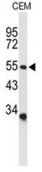 Acid Sensing Ion Channel Subunit 1 antibody, GTX80451, GeneTex, Western Blot image 