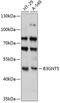 UDP-GlcNAc:BetaGal Beta-1,3-N-Acetylglucosaminyltransferase 5 antibody, A11494, Boster Biological Technology, Western Blot image 