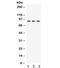 AFG3-like protein 2 antibody, R32419, NSJ Bioreagents, Western Blot image 