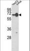 Heterogeneous Nuclear Ribonucleoprotein L antibody, LS-C164966, Lifespan Biosciences, Western Blot image 