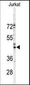 Gap Junction Protein Alpha 3 antibody, orb96107, Biorbyt, Western Blot image 