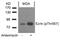 Lysine Demethylase 6A antibody, 79-471, ProSci, Western Blot image 