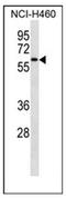 Interleukin 1 Receptor Associated Kinase 4 antibody, AP52231PU-N, Origene, Western Blot image 