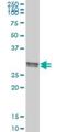 Chloride Intracellular Channel 1 antibody, H00001192-M02, Novus Biologicals, Western Blot image 