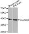 Calcium Voltage-Gated Channel Auxiliary Subunit Gamma 2 antibody, STJ28620, St John