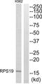 Ribosomal Protein S19 antibody, abx014096, Abbexa, Western Blot image 