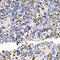 Ubiquitin Conjugating Enzyme E2 V2 antibody, LS-C349009, Lifespan Biosciences, Immunohistochemistry paraffin image 