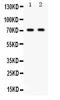 Frizzled Class Receptor 1 antibody, PB9594, Boster Biological Technology, Western Blot image 
