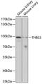 Thrombospondin 3 antibody, 19-117, ProSci, Western Blot image 