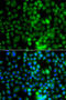 EPH Receptor A1 antibody, STJ29467, St John