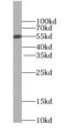 Tubulointerstitial Nephritis Antigen antibody, FNab08712, FineTest, Western Blot image 