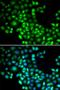 Histamine N-Methyltransferase antibody, orb167179, Biorbyt, Immunocytochemistry image 