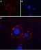 Purinergic Receptor P2X 3 antibody, PA5-77682, Invitrogen Antibodies, Immunocytochemistry image 
