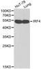 Interferon Regulatory Factor 4 antibody, LS-C192325, Lifespan Biosciences, Western Blot image 