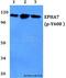 EPH Receptor A7 antibody, A03943Y608, Boster Biological Technology, Western Blot image 