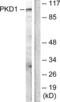 Serine/threonine-protein kinase D1 antibody, LS-B7000, Lifespan Biosciences, Western Blot image 
