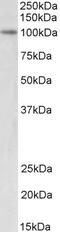 MYB Proto-Oncogene Like 2 antibody, 45-923, ProSci, Enzyme Linked Immunosorbent Assay image 